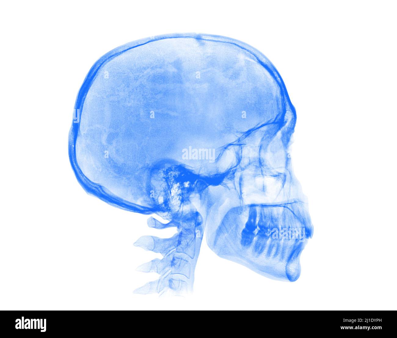 Crâne humain. Image radiologique bleue isolée sur fond blanc Banque D'Images
