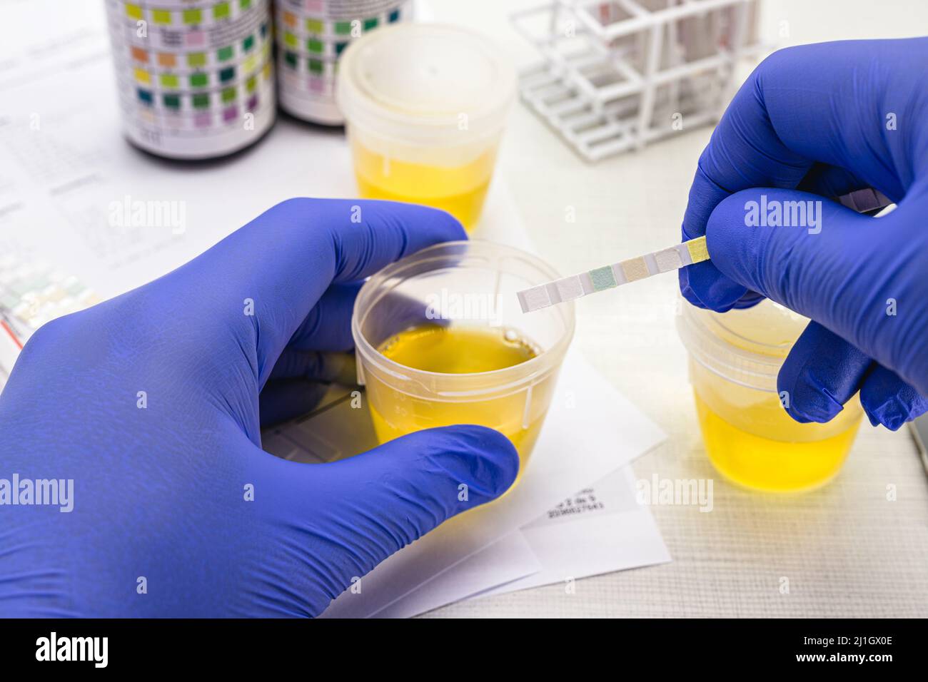 Comment Faire Une Analysed'urine Avec Flacon En Video Test urinaire, réalisé avec un flacon de bandelette de réactif d