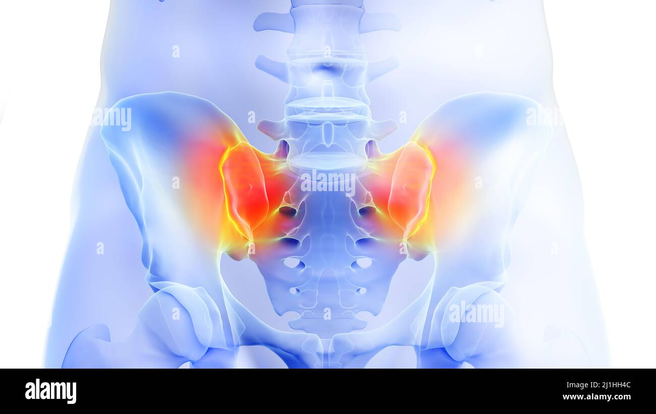 Articulation sacroiliaque douloureuse, illustration Photo Stock Alamy