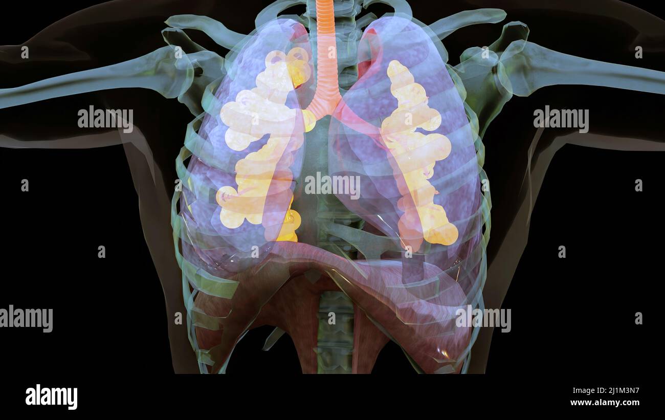 Système respiratoire humain poumons Anatomy animation concept. Poumon visible, ventilation pulmonaire, trachée, réaliste haute qualité 3D illustration médicale Banque D'Images