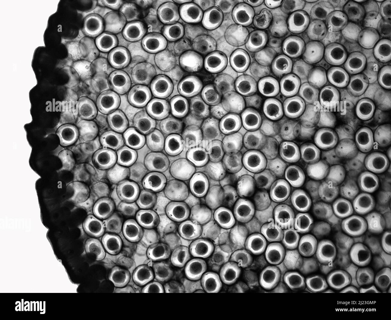 Œufs de fragmentation de la tordeuse des bourgeons (Ascaris megalocephala). Micrographe léger. Stade Syncarion. Banque D'Images
