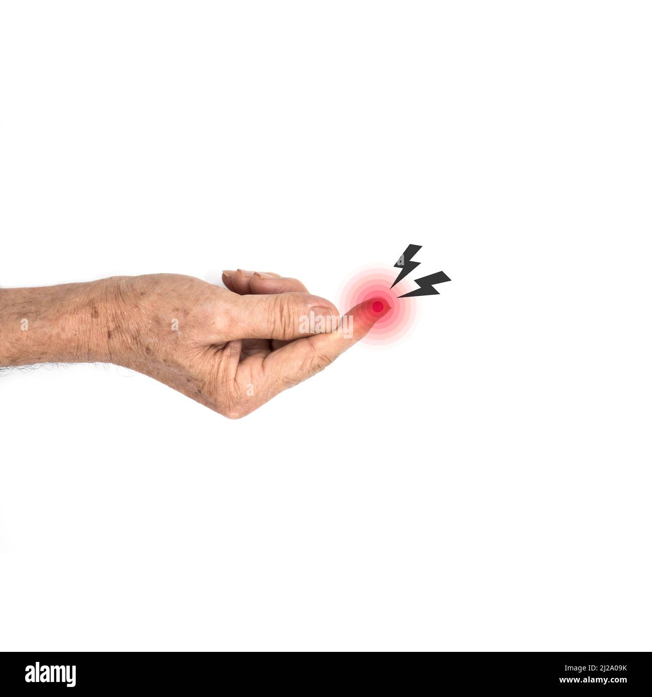 Inflammation du bout des doigts du vieil homme asiatique. Concept de cellulite et problèmes de doigt. Banque D'Images