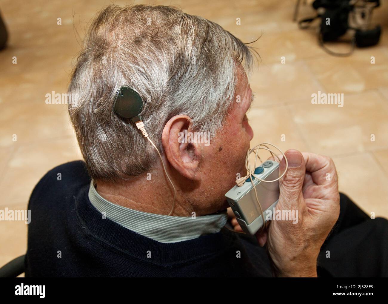 Pays-Bas, Un implant cochléaire est un dispositif électronique implanté chirurgicalement qui donne un sens du son à une personne qui est profondément sourde ou qui est sourde Banque D'Images