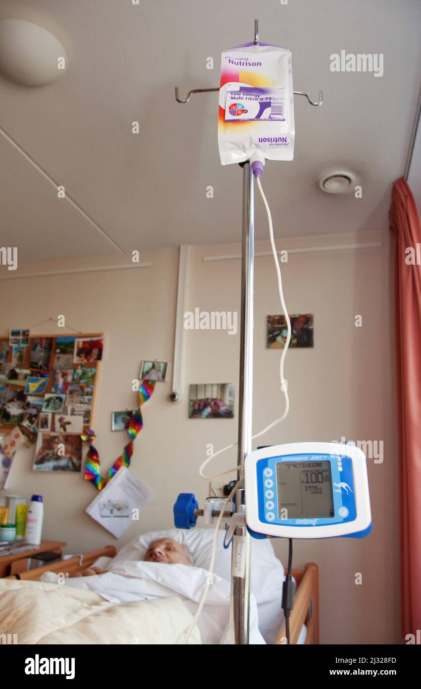 La gastrostomie endoscopique percutanée (PEG) est une procédure médicale endoscopique dans laquelle un tube (tube PEG) est passé dans l'estomac d'un patient par le Banque D'Images