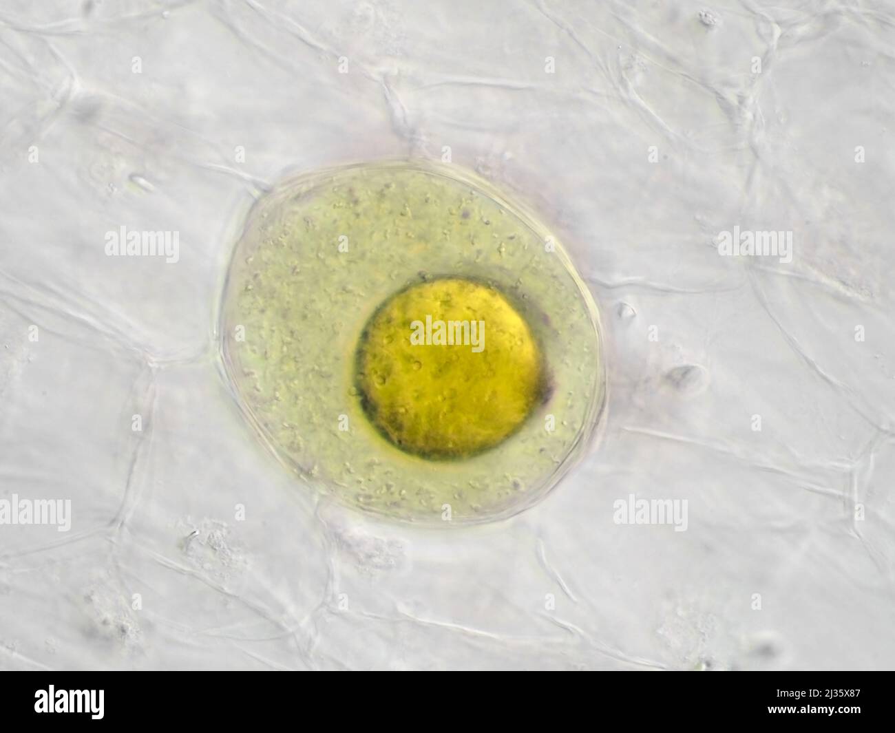 Le gingembre de sushi pické sous le microscope, montrant une cellule sécrétrice avec une globule d'huile Banque D'Images