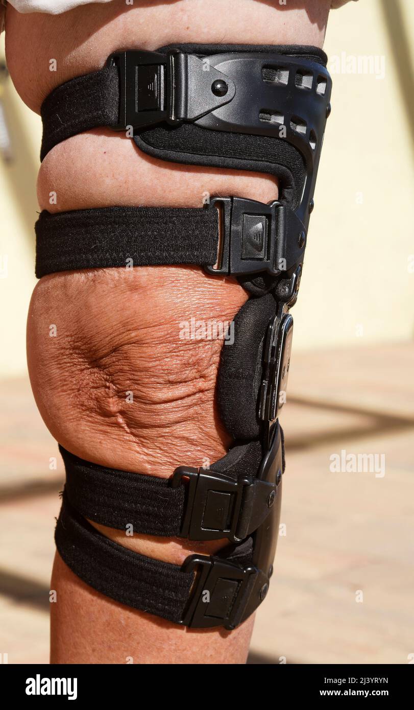 grand corset, jambe de l'homme, douleur au genou, soutien, problème  orthopédique, Médical, IRM Photo Stock - Alamy