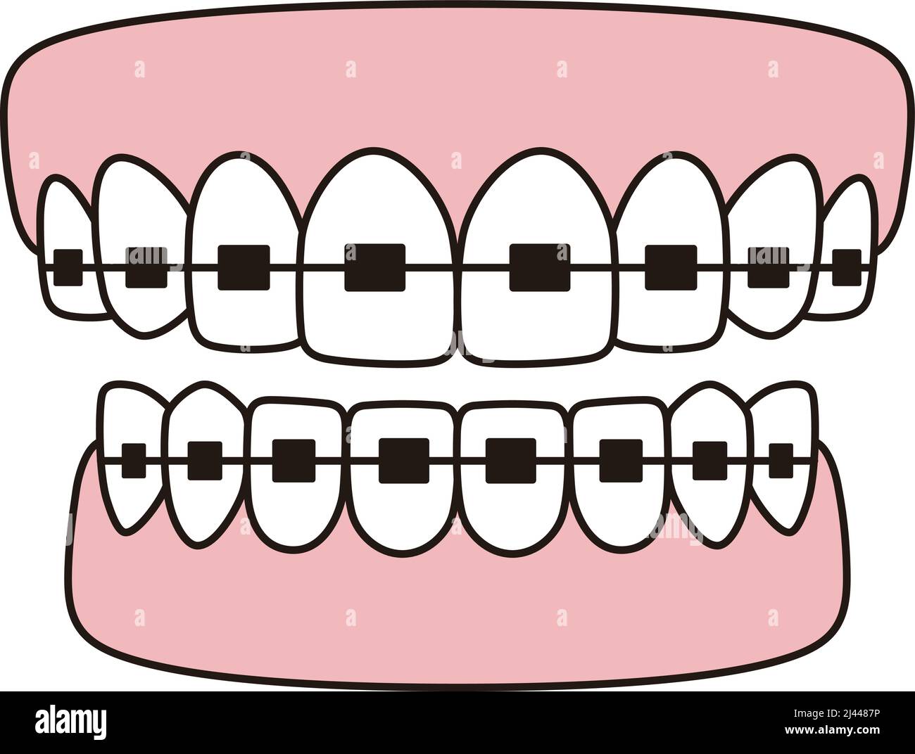 Icônes d'accolades dents, illustration vectorielle plate Illustration de Vecteur