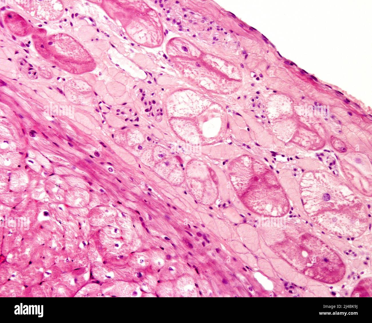 Fibres de Purkinje dans le coeur, micrographe léger Banque D'Images