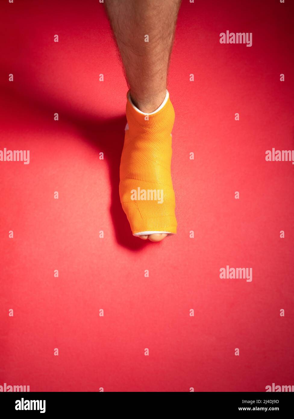Pied avec un orteil cassé sur fond rose orange en fibre de verre moulé. Blessé fracture de la jambe mâle gonflée dans une coulée orthopédique moderne imperméable faite de s. Banque D'Images