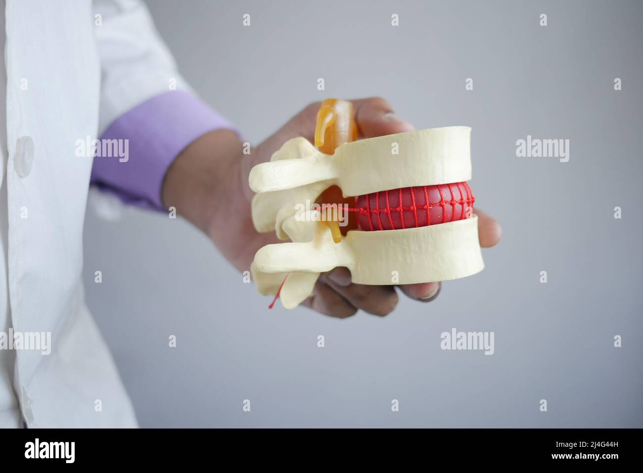 Médecin tenant un échantillon de moelle épinière Banque D'Images