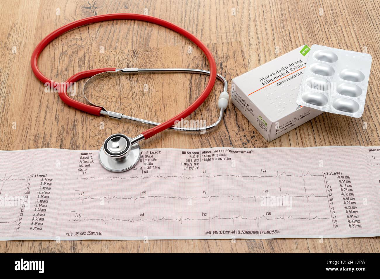Un ECG à tracé cardiaque avec une boîte générique de comprimés de statine et un stéthoscope Banque D'Images
