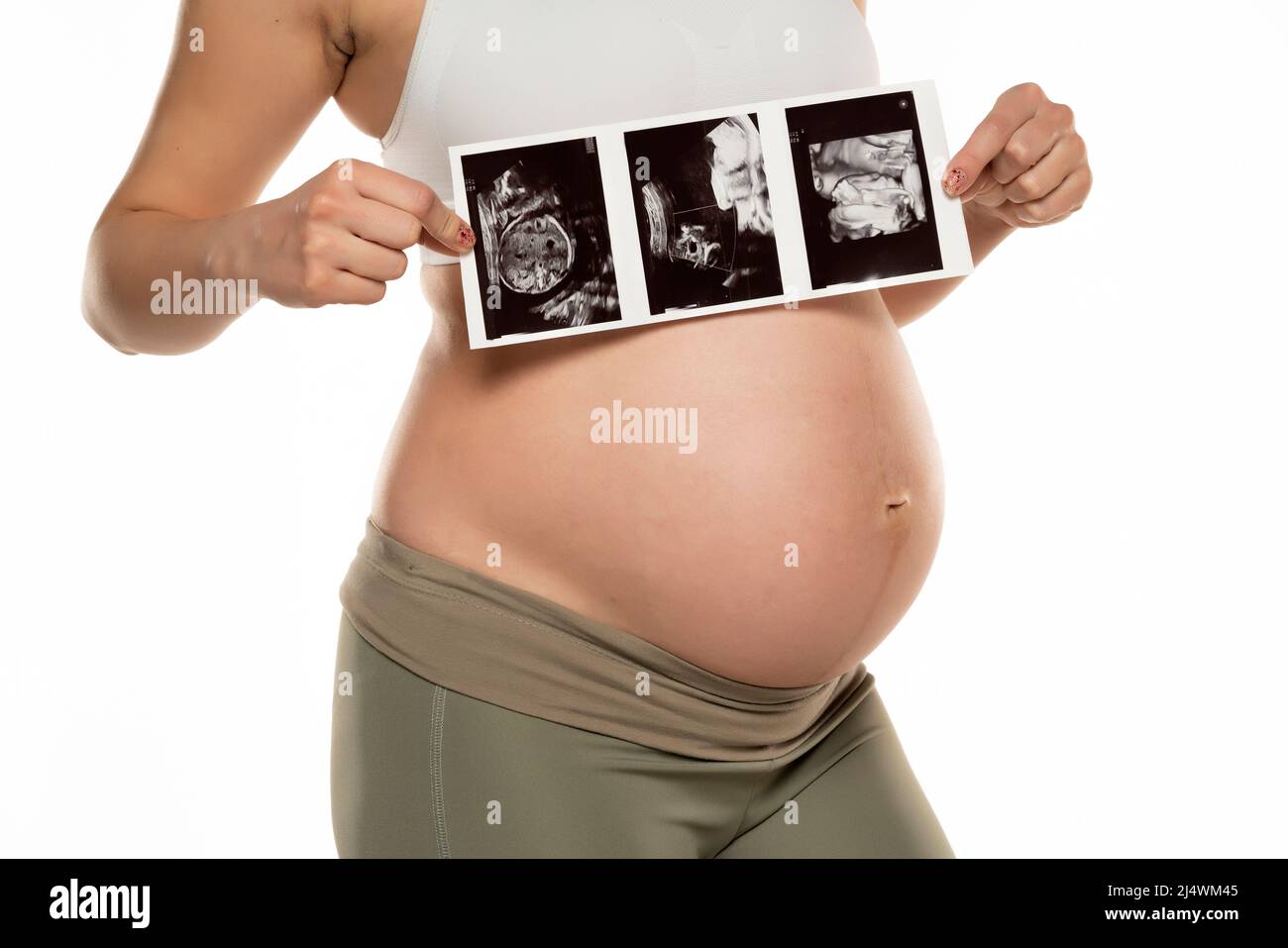 Femme enceinte avec des images échographiques sur fond blanc. Banque D'Images