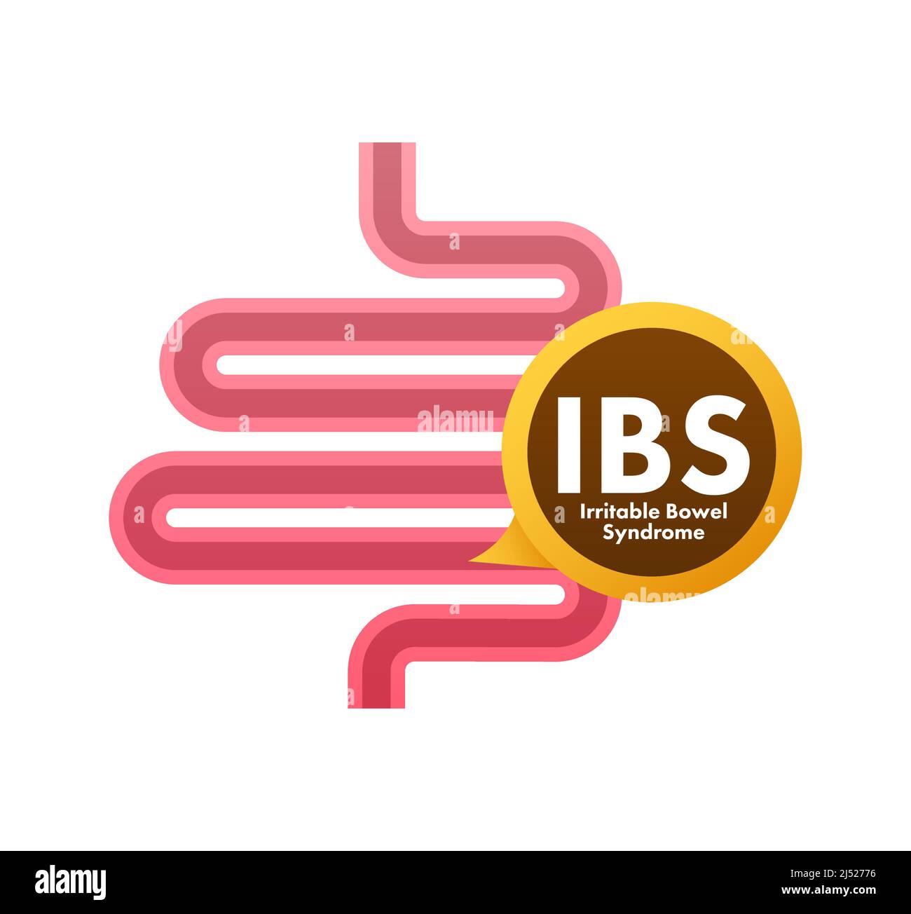 Signes du syndrome du côlon irritable. Messages de santé sur le diagnostic de l'IBS. Illustration du stock vectoriel. Illustration de Vecteur