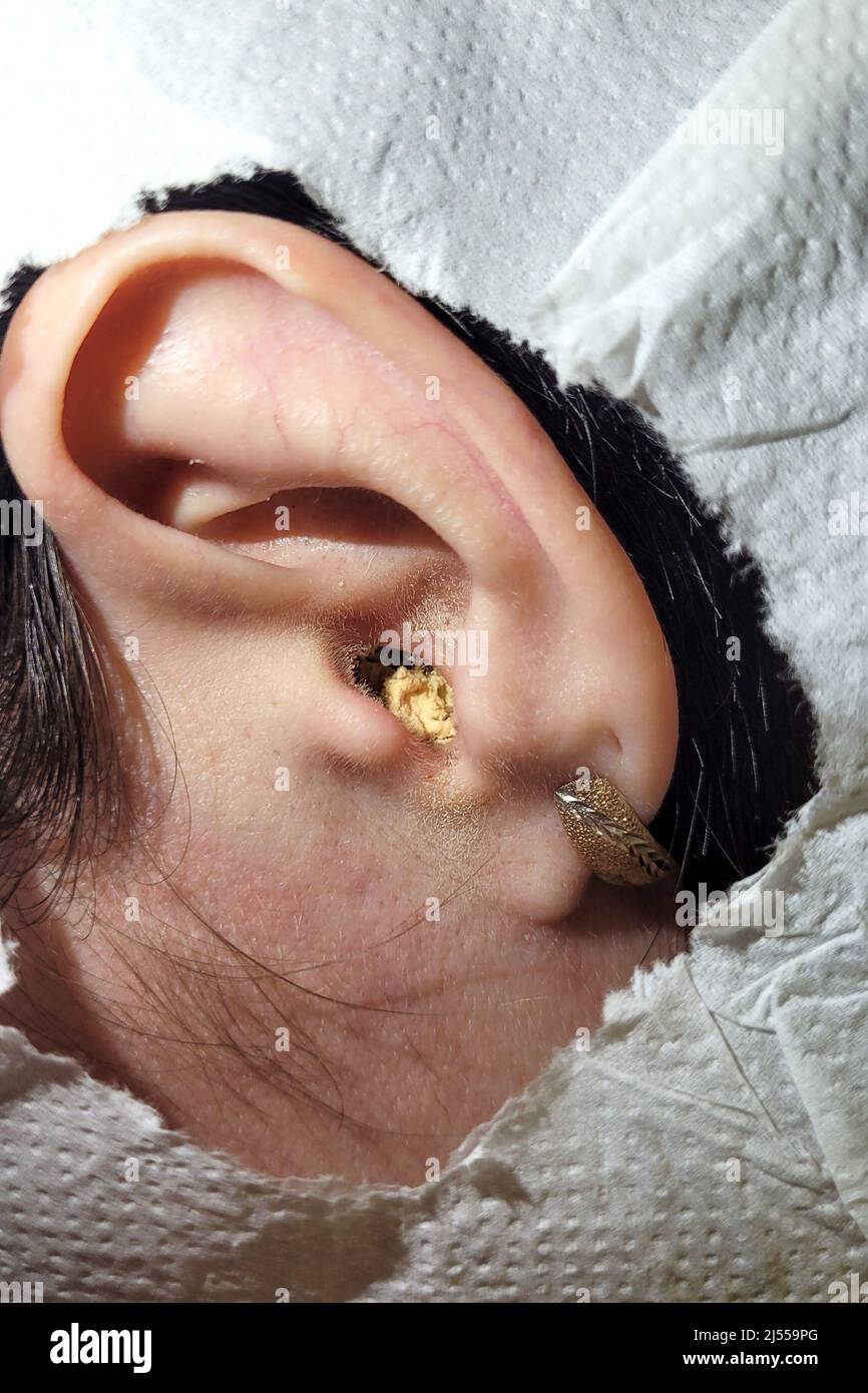 Oreille humaine avec un contour d'oreille gris jaune à l'intérieur obstrué  Photo Stock - Alamy