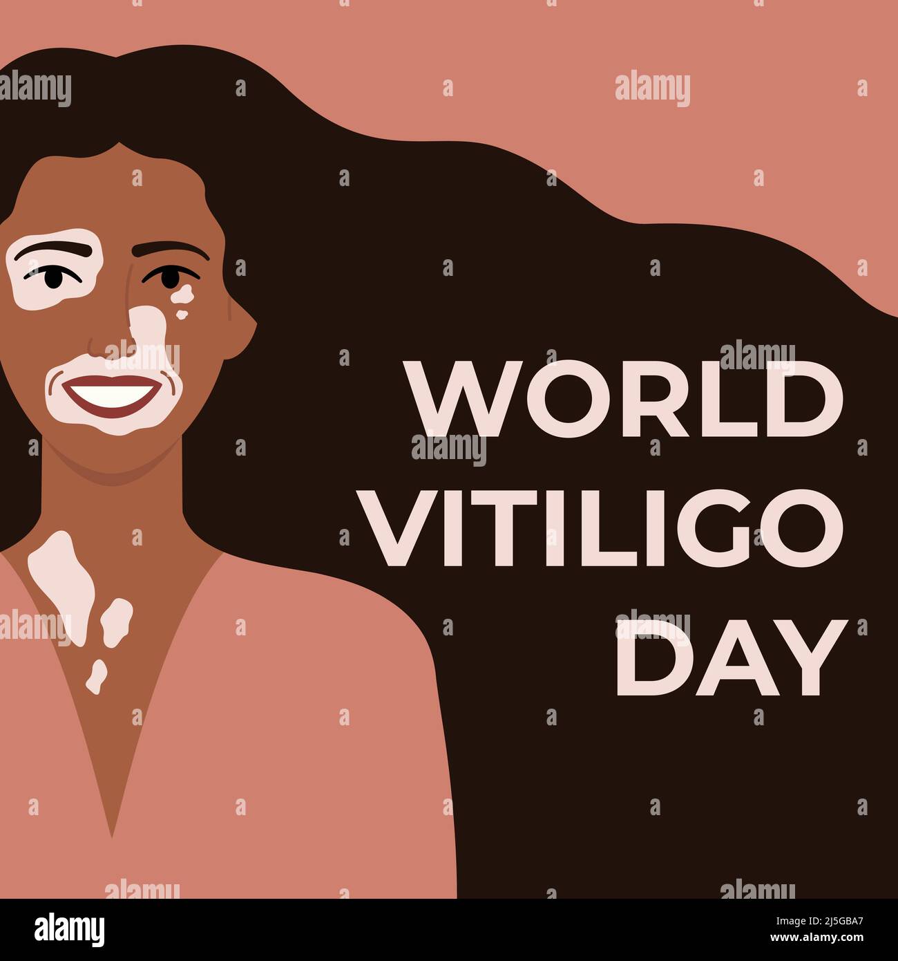 Journée mondiale de vitiligo juin 25 bannière carrée. Visage d'une femme africaine atteinte d'une maladie de la peau de vitiligo. Concept positif du corps. Illustration vectorielle plate Illustration de Vecteur