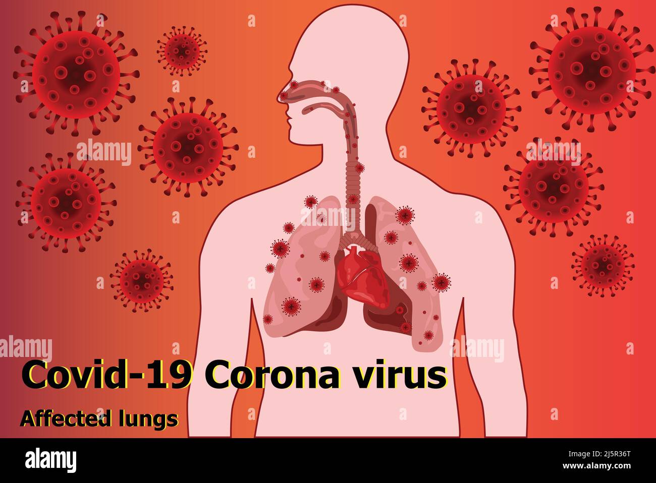 Le coronavirus Covid-19 a affecté les poumons Illustration de Vecteur