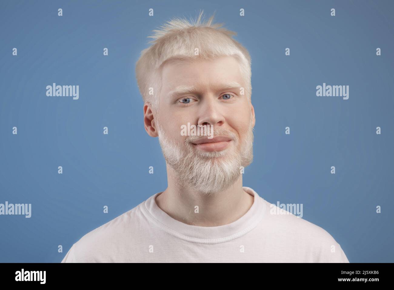 Notion : anomalie de la peau. Portrait d'albinos barbu posé à l'appareil photo sur fond bleu studio Banque D'Images