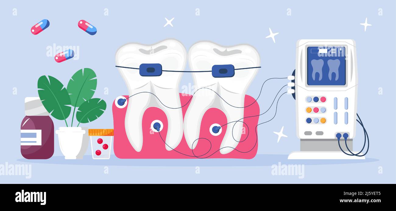 Concept de vecteur de services dentaires pour la page d'arrivée. Les dentistes font une radiographie des dents pour aider les maux de dents, blanchir l'émail ou l'implant de récupération. Illustration de Vecteur