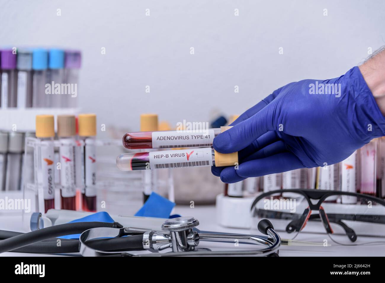 Suspicion d'adénovirus en tant que coupable de l'hépatite infantile d'origine inconnue. Hépatique, sras-cov2. Banque D'Images