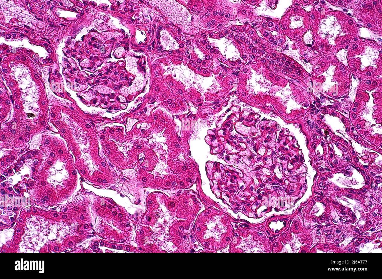 Glycogénose, micrographe léger Banque D'Images