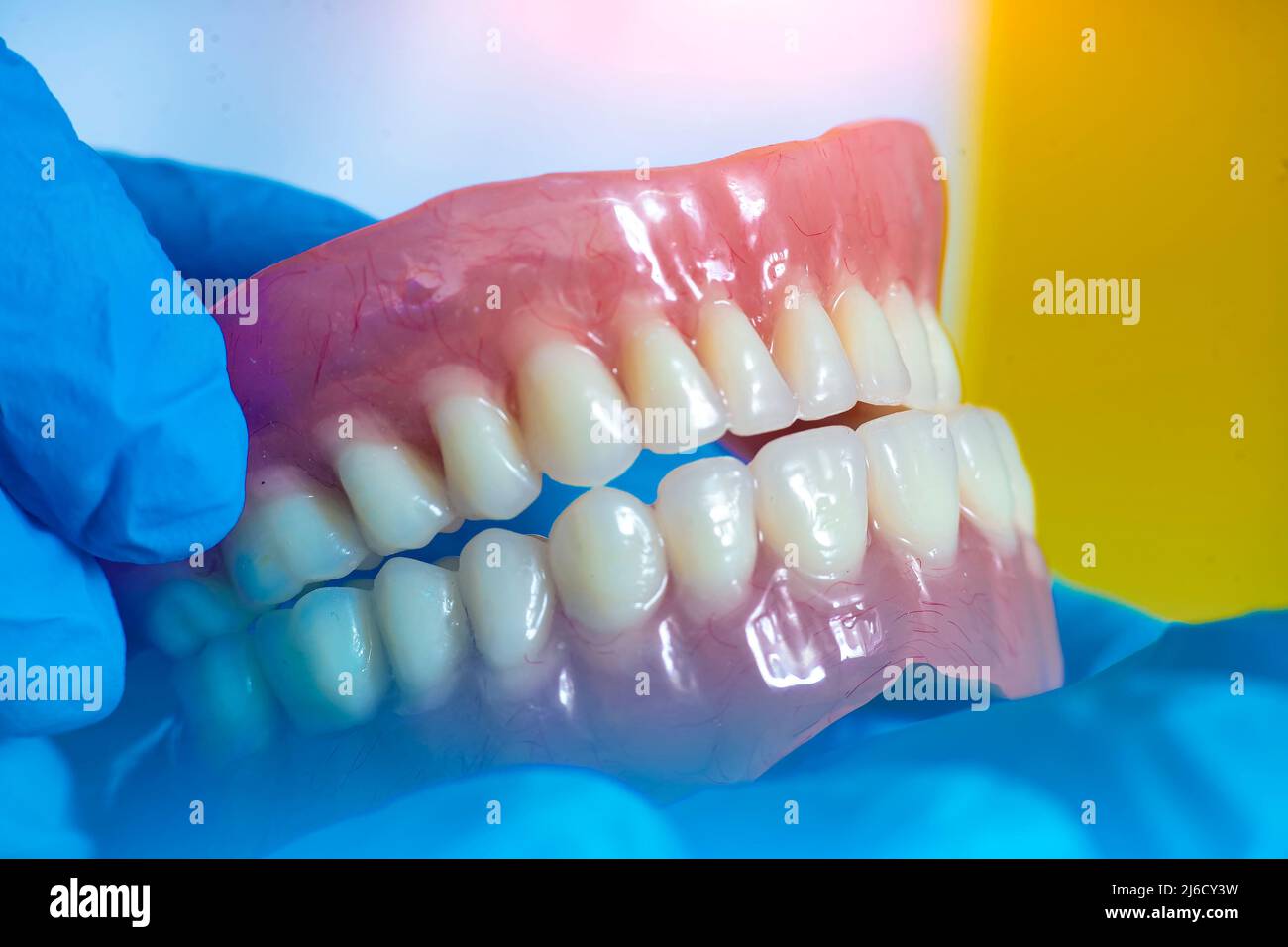 Prothèse dentaire dans les mains du médecin en gros plan.Dentiste tenant un pont dentaire en céramique.Vue avant de la prothèse complète.Pho conceptuel de la dentisterie Banque D'Images
