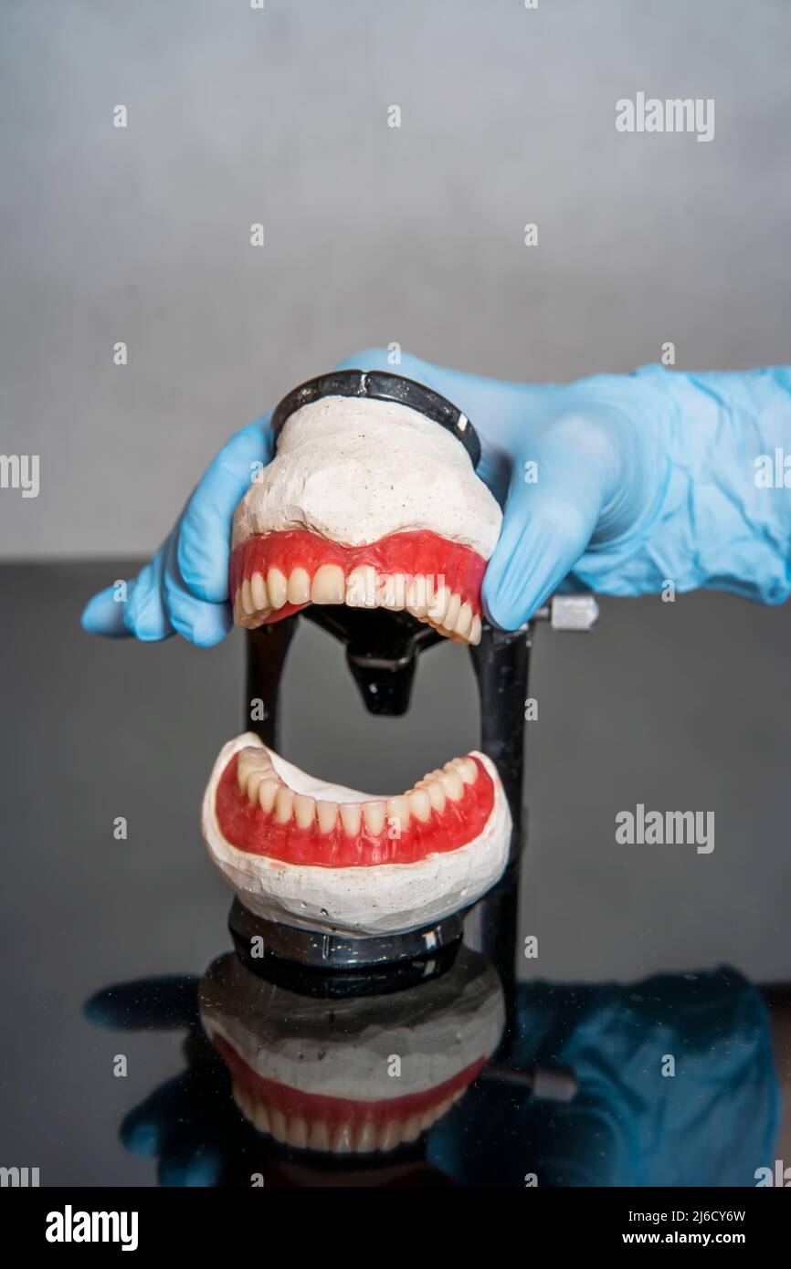 Prothèse dentaire dans les mains du médecin en gros plan.Dentiste tenant un pont dentaire en céramique.Vue avant de la prothèse complète.Pho conceptuel de la dentisterie Banque D'Images