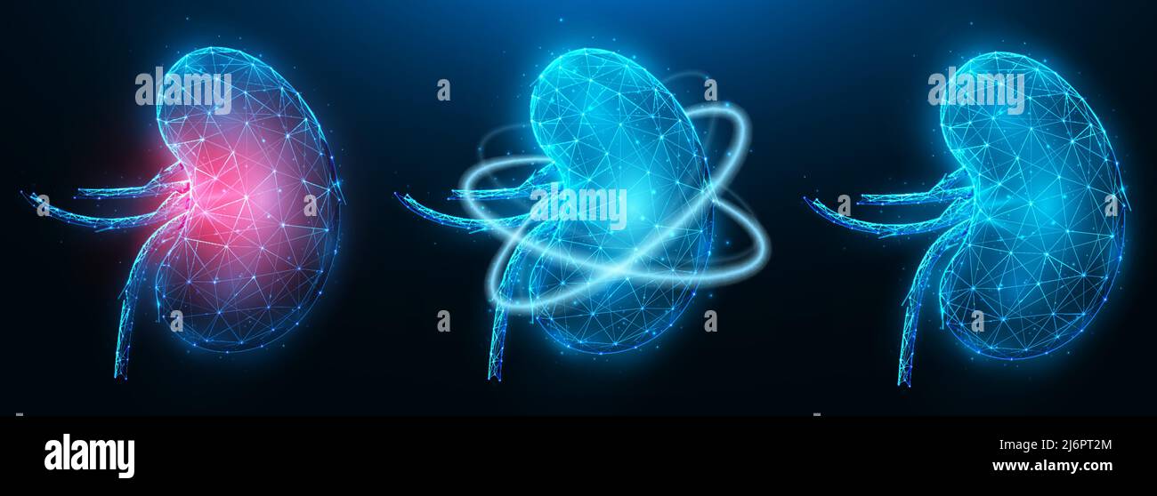 Illustration vectorielle polygonale d'un rein malade enflammé, d'un rein sain et d'une récupération des fonctions rénales. Bannière médicale urologique ou néphrologie, tem Illustration de Vecteur