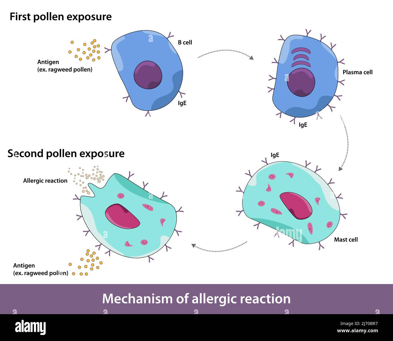 Mécanisme d'allergie. Les antigènes comme le grain de pollen sont inoffensifs mais conduisent à une hypersensibilité et à l'activation de la dégranulation des mastocytes. Illustration de Vecteur