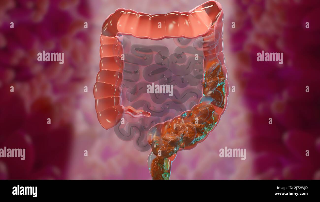 3d illustration de l'anatomie du système digestif humain, concept de l'intestin, laxatif, traitement de la constipation, 3d rendu Banque D'Images