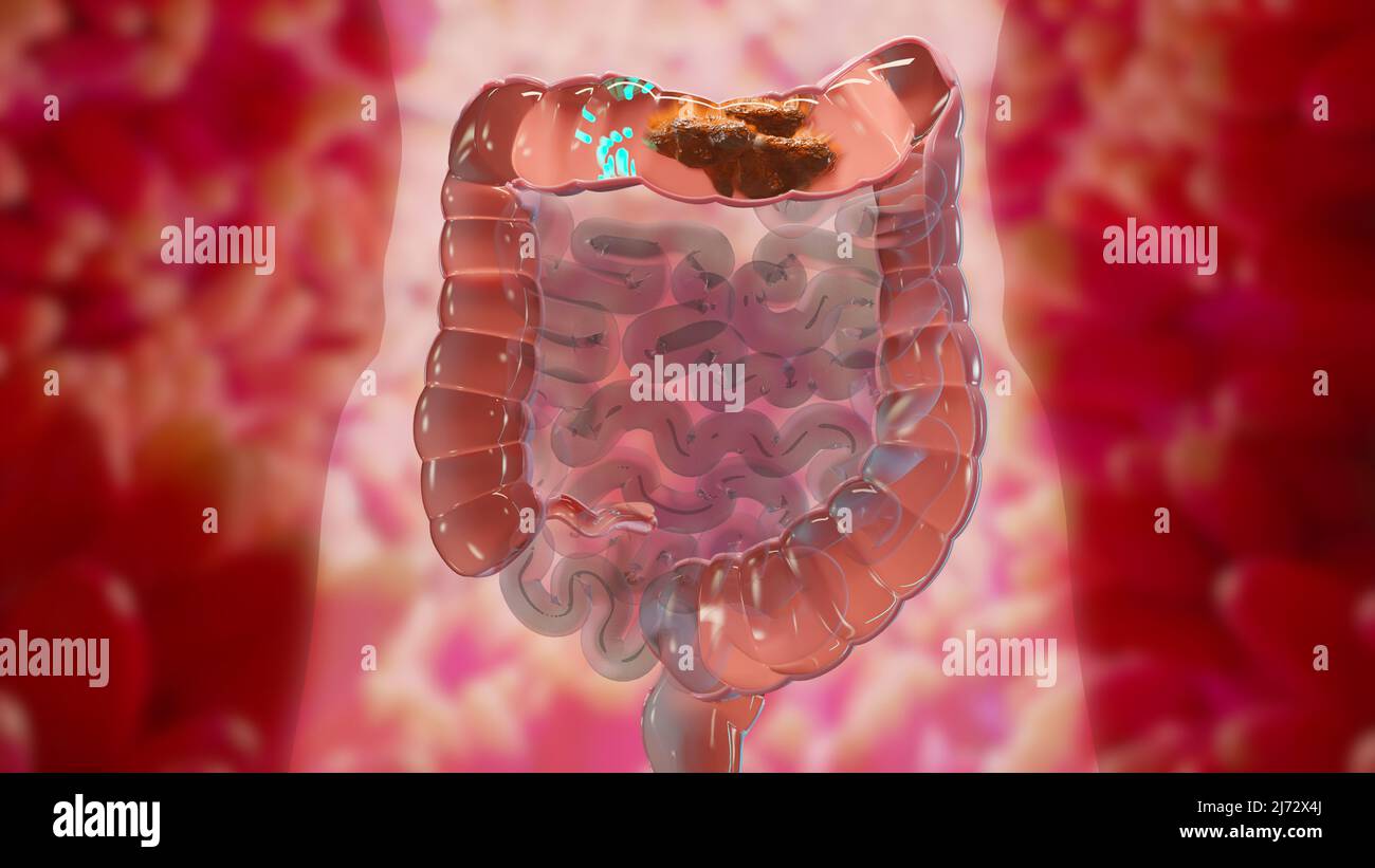 3d illustration de l'anatomie du système digestif humain, concept de l'intestin, laxatif, traitement de la constipation, 3d rendu Banque D'Images