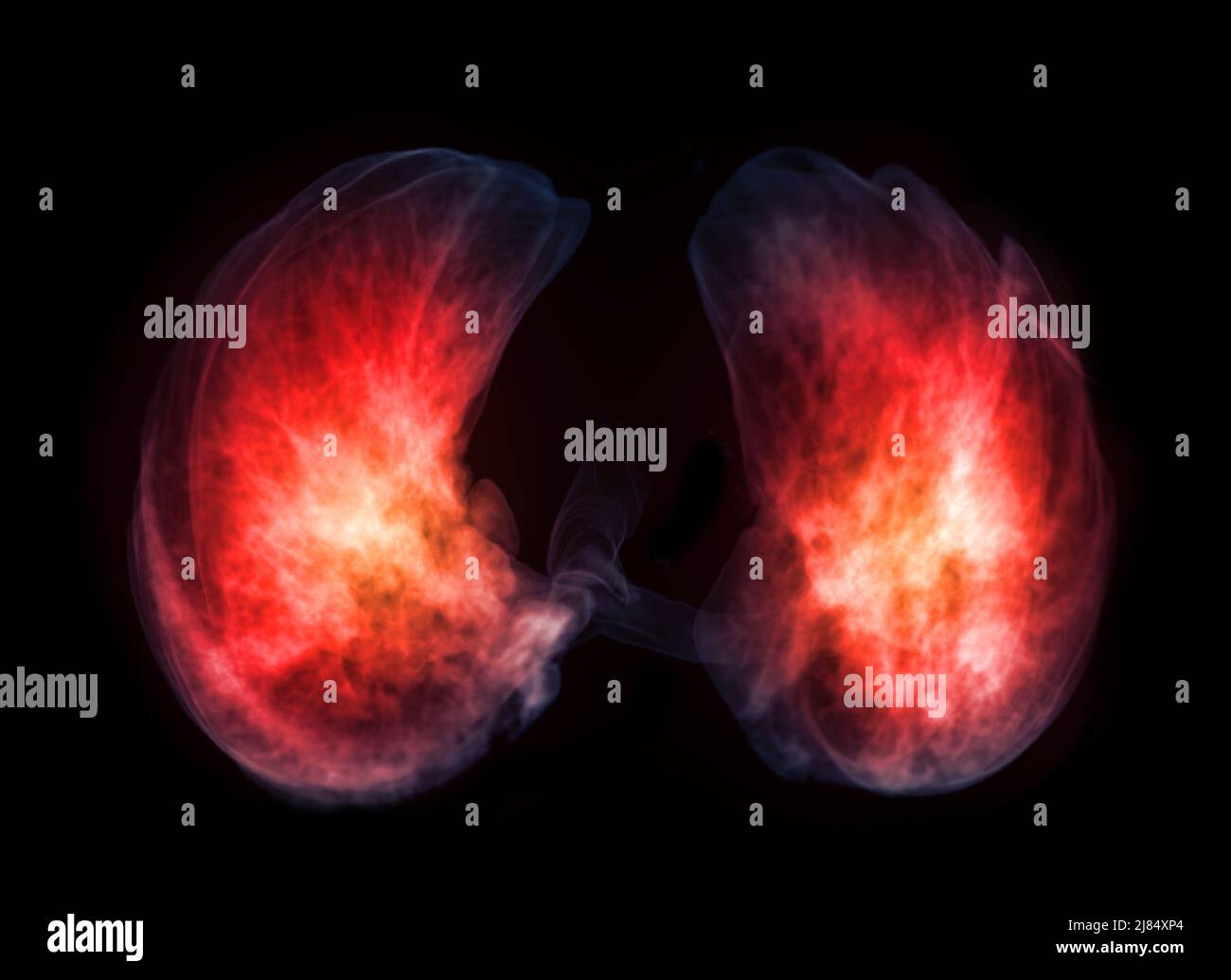 Base de Lung 3D image de rendu pour le diagnostic TB, tuberculose et Covid-19 de CT-scanner 3D. Banque D'Images