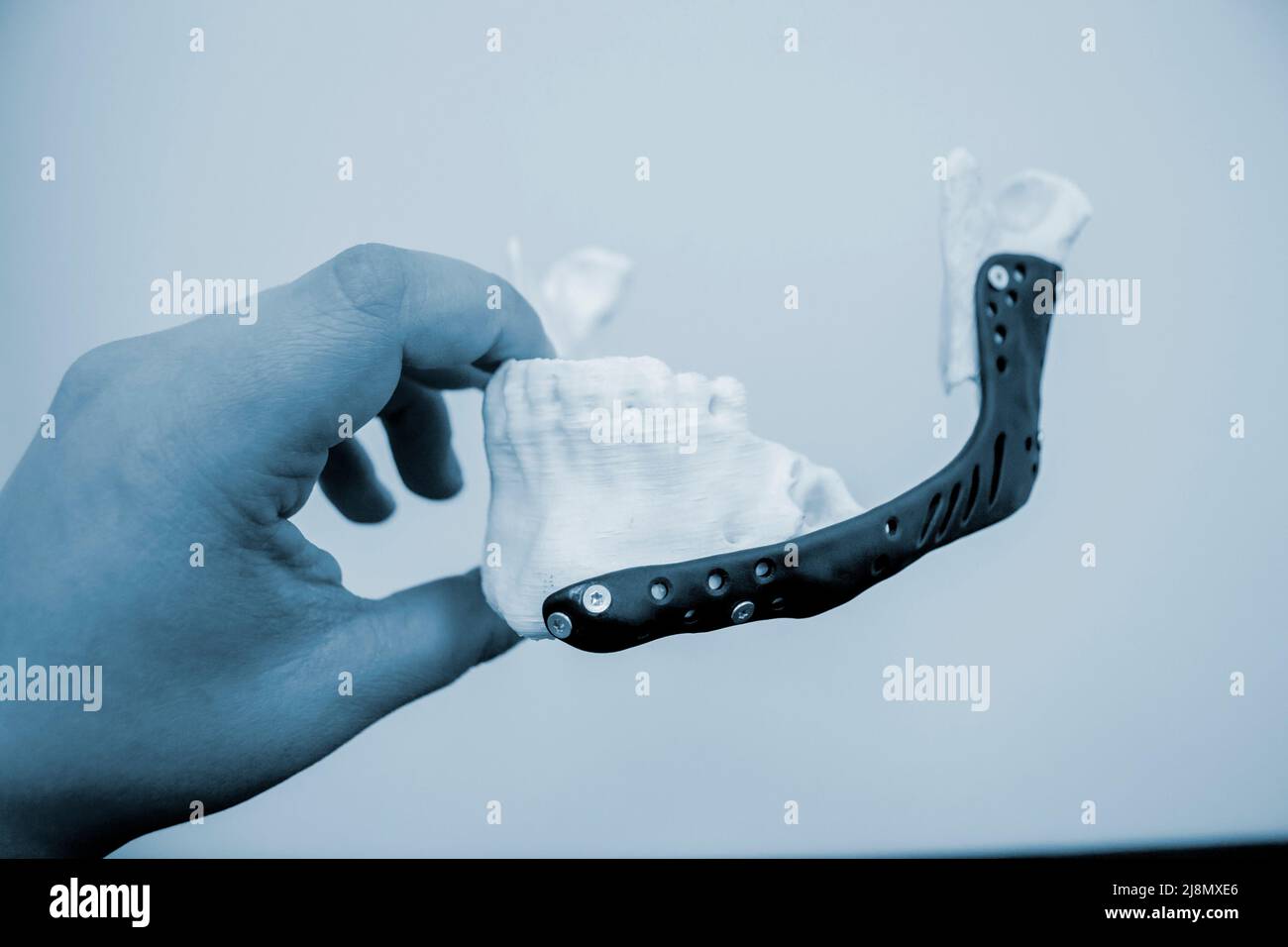 La personne tient en main un exemple de mâchoire artificielle imprimée sur l'imprimante 3D Banque D'Images
