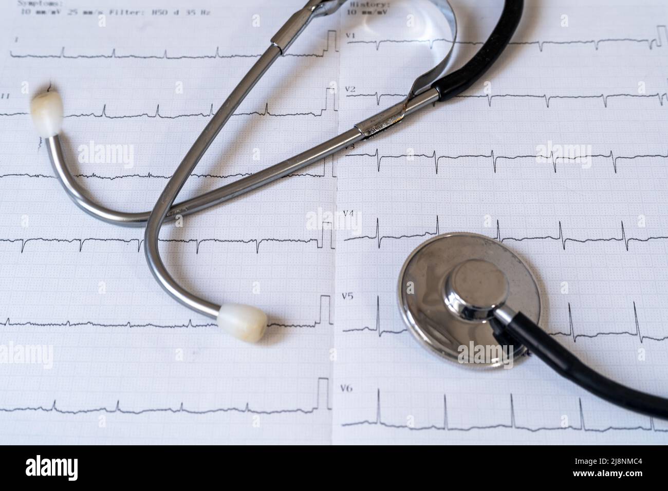 Gros plan du stéthoscope et du papier de résultats de test ecg. Concept de santé cardiaque et de contrôle cardio. Banque D'Images