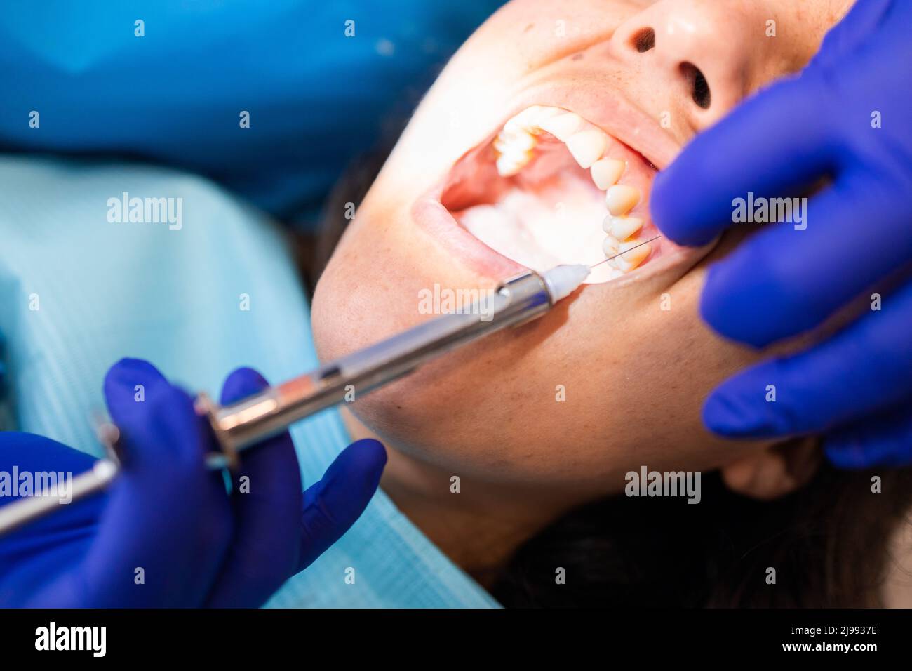 Mains du dentiste donnant l'anesthésie dentaire avec une seringue à sa patiente. Mise au point sélective. Banque D'Images