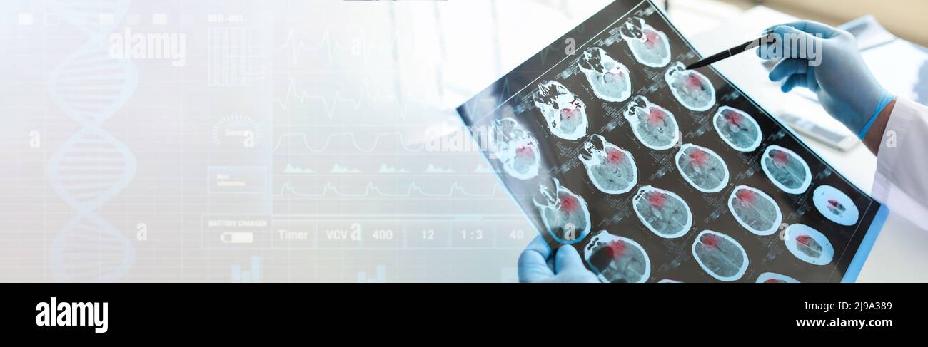 Neurologue avec IRM du cerveau humain en clinique. Bannière pour le design Banque D'Images