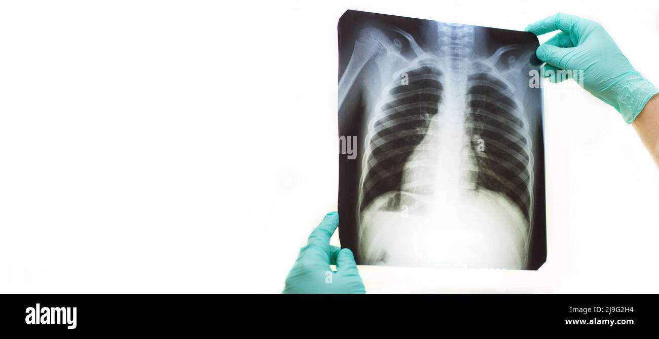 Main d'homme tenant une radiographie des poumons isolée sur un fond blanc. Médecin portant un masque et des gants en regardant la radiographie thoracique Banque D'Images