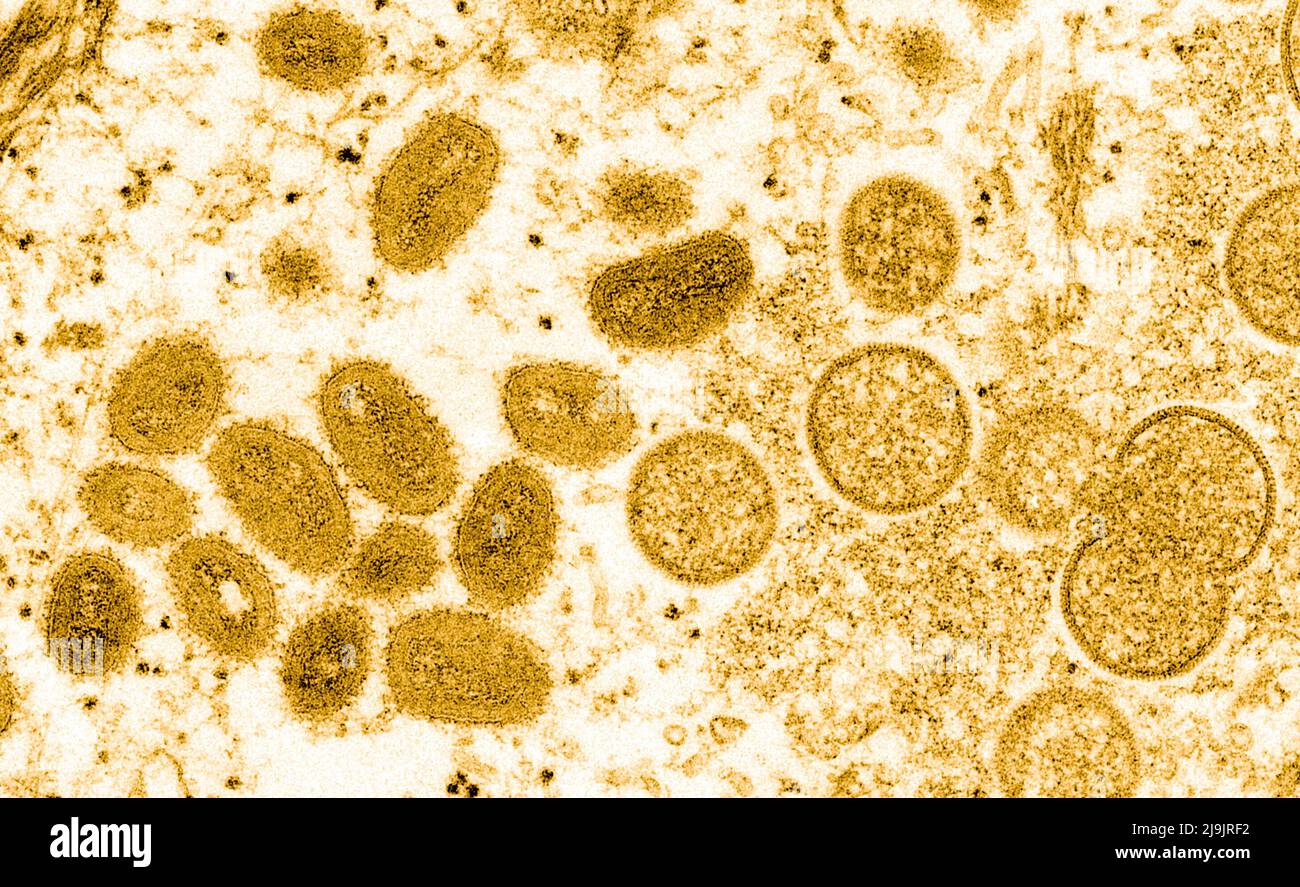 VIRUS DE LA VARIOLE DU SINGE. Cette image microscopique électronique (EM) a représenté un virion de la variole du singe, obtenu à partir d'un échantillon clinique associé à l'éclosion de chien de prairie de 2003. Il s'agissait d'une image de coupe mince d'un échantillon de peau humaine. À gauche se trouvaient des particules de virus matures de forme ovale, et à droite, des croissants et des particules sphériques de virions immatures. Banque D'Images