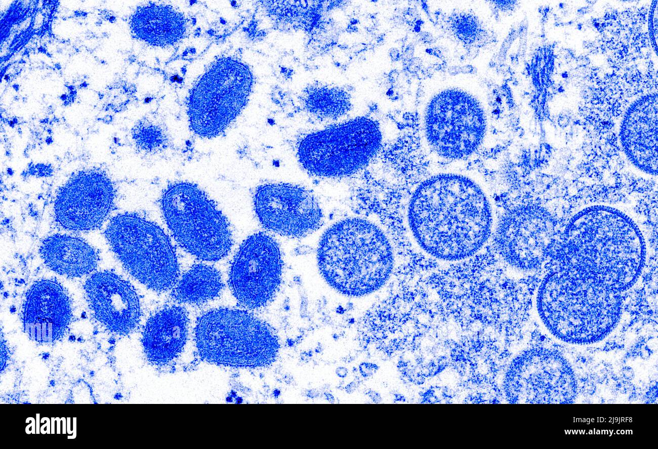 VIRUS DE LA VARIOLE DU SINGE. Cette image microscopique électronique (EM) a représenté un virion de la variole du singe, obtenu à partir d'un échantillon clinique associé à l'éclosion de chien de prairie de 2003. Il s'agissait d'une image de coupe mince d'un échantillon de peau humaine. À gauche se trouvaient des particules de virus matures de forme ovale, et à droite, des croissants et des particules sphériques de virions immatures. Banque D'Images