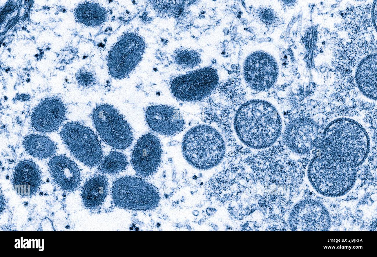 VIRUS DE LA VARIOLE DU SINGE. Cette image microscopique électronique (EM) a représenté un virion de la variole du singe, obtenu à partir d'un échantillon clinique associé à l'éclosion de chien de prairie de 2003. Il s'agissait d'une image de coupe mince d'un échantillon de peau humaine. À gauche se trouvaient des particules de virus matures de forme ovale, et à droite, des croissants et des particules sphériques de virions immatures. Banque D'Images