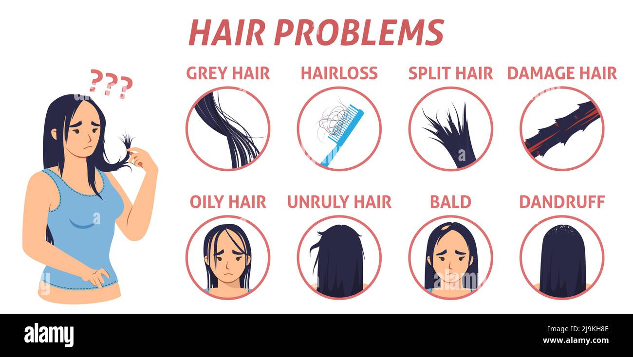 Affiche vectorielle des symptômes de perte de cheveux chez la femme Illustration de Vecteur