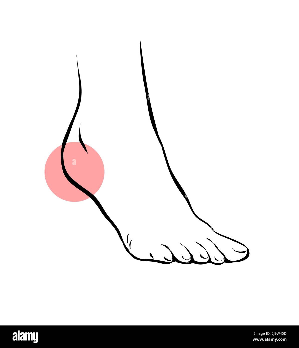 Dessinez la ligne de la jambe femelle avec une douleur problématique. Talon douloureux. Maladie orthopédique fasciite plantaire. Beauté et santé des pieds. Contour vectoriel isolé illu Illustration de Vecteur