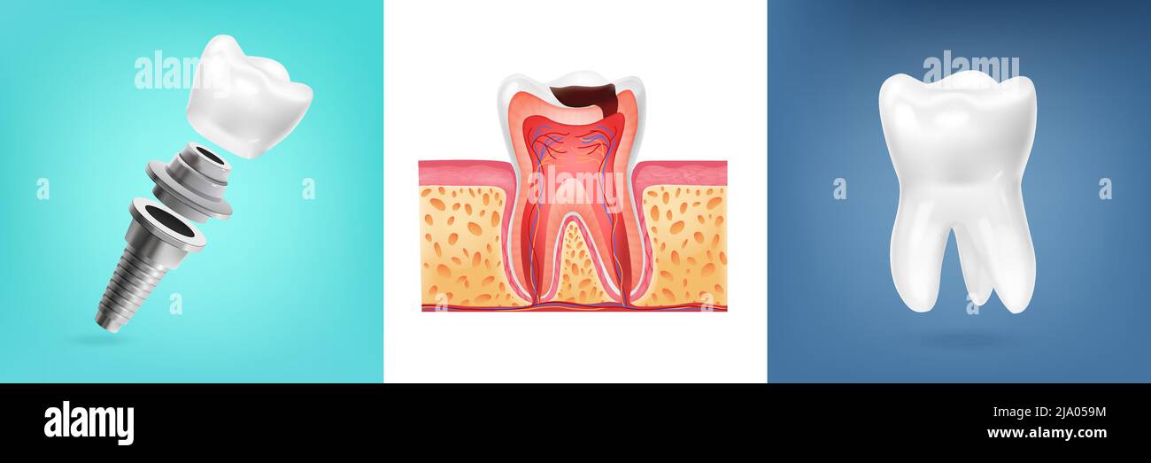 Concept réaliste avec anatomie des dents humaines et illustration du vecteur post-isolé dentaire Illustration de Vecteur