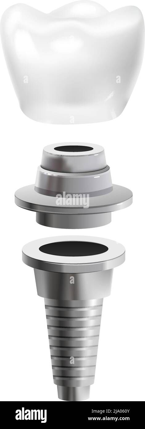Poteau dentaire en métal réaliste icône illustration de vecteur isolé Illustration de Vecteur