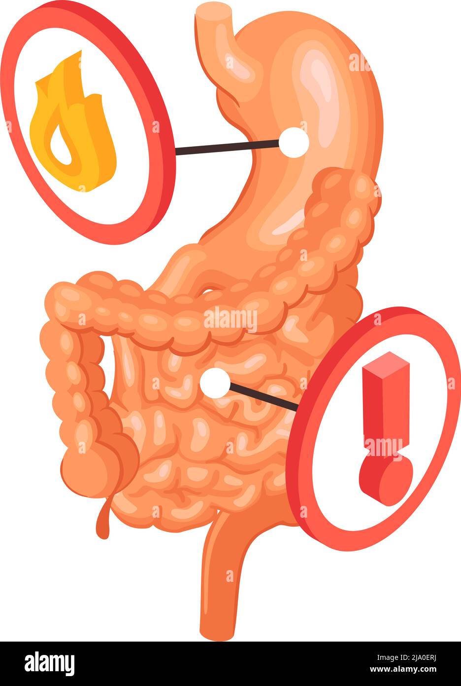 Composition en gastroentérologie isométrique avec vue des entrailles avec l'estomac et les icônes de mise en garde illustration vectorielle Illustration de Vecteur