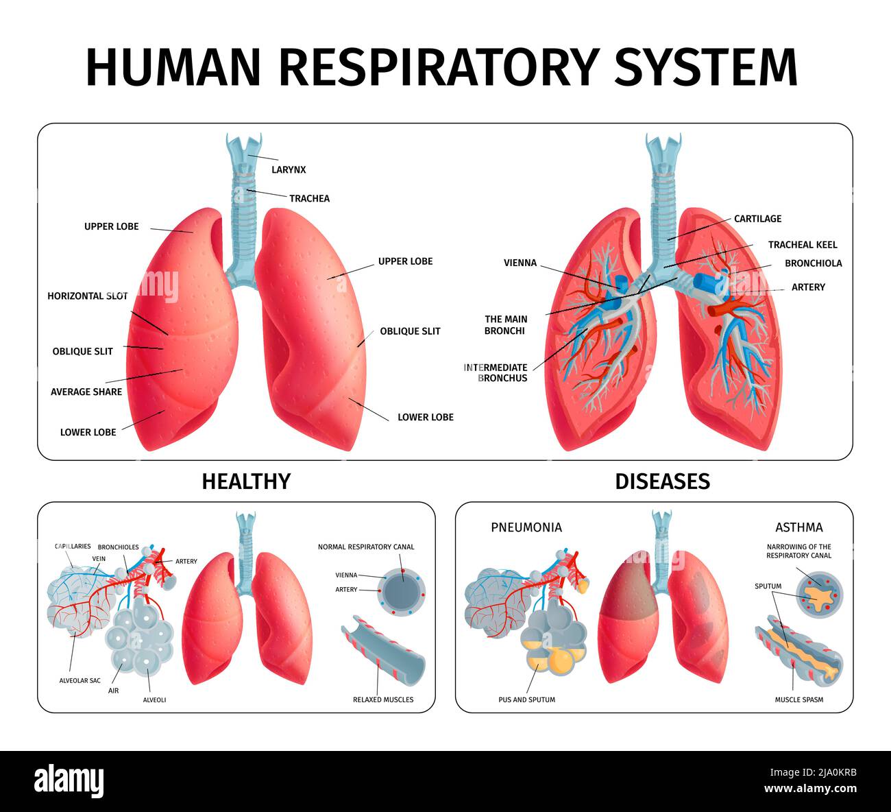 Système respiratoire humain anatomie physiologie pathologie maladies pulmonaires pneumonie asthme médical éducatif infographique bannières vecteur illustrati Illustration de Vecteur