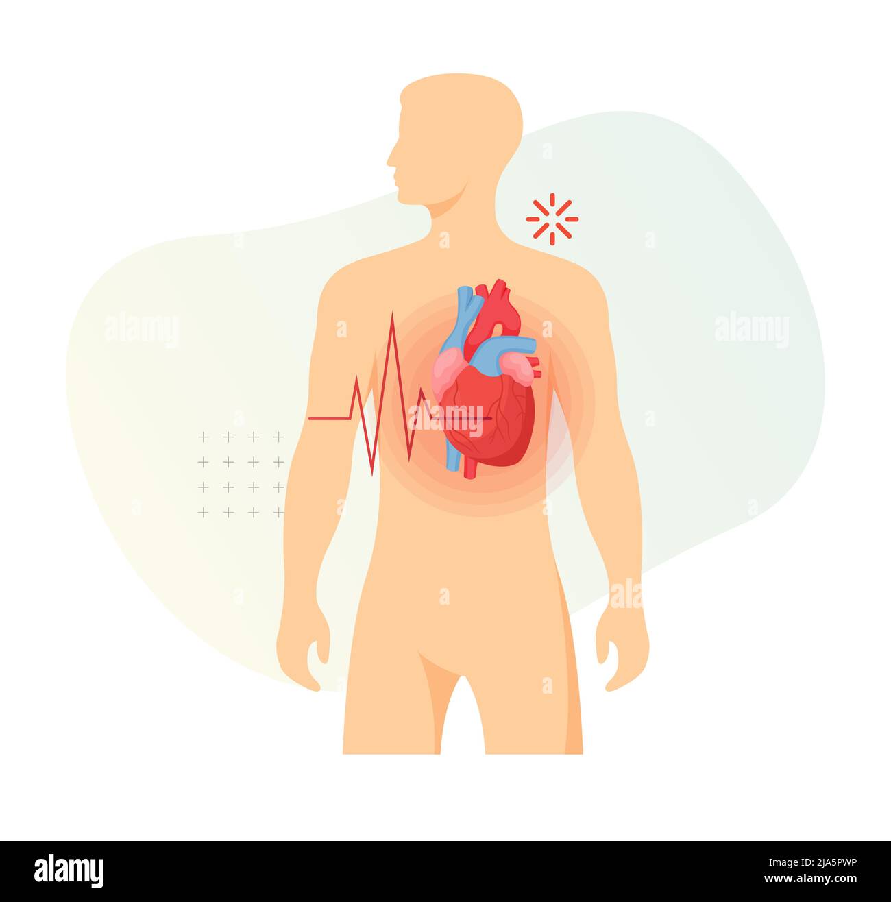 Symptômes de crise cardiaque - icône de stock comme fichier EPS 10 Illustration de Vecteur