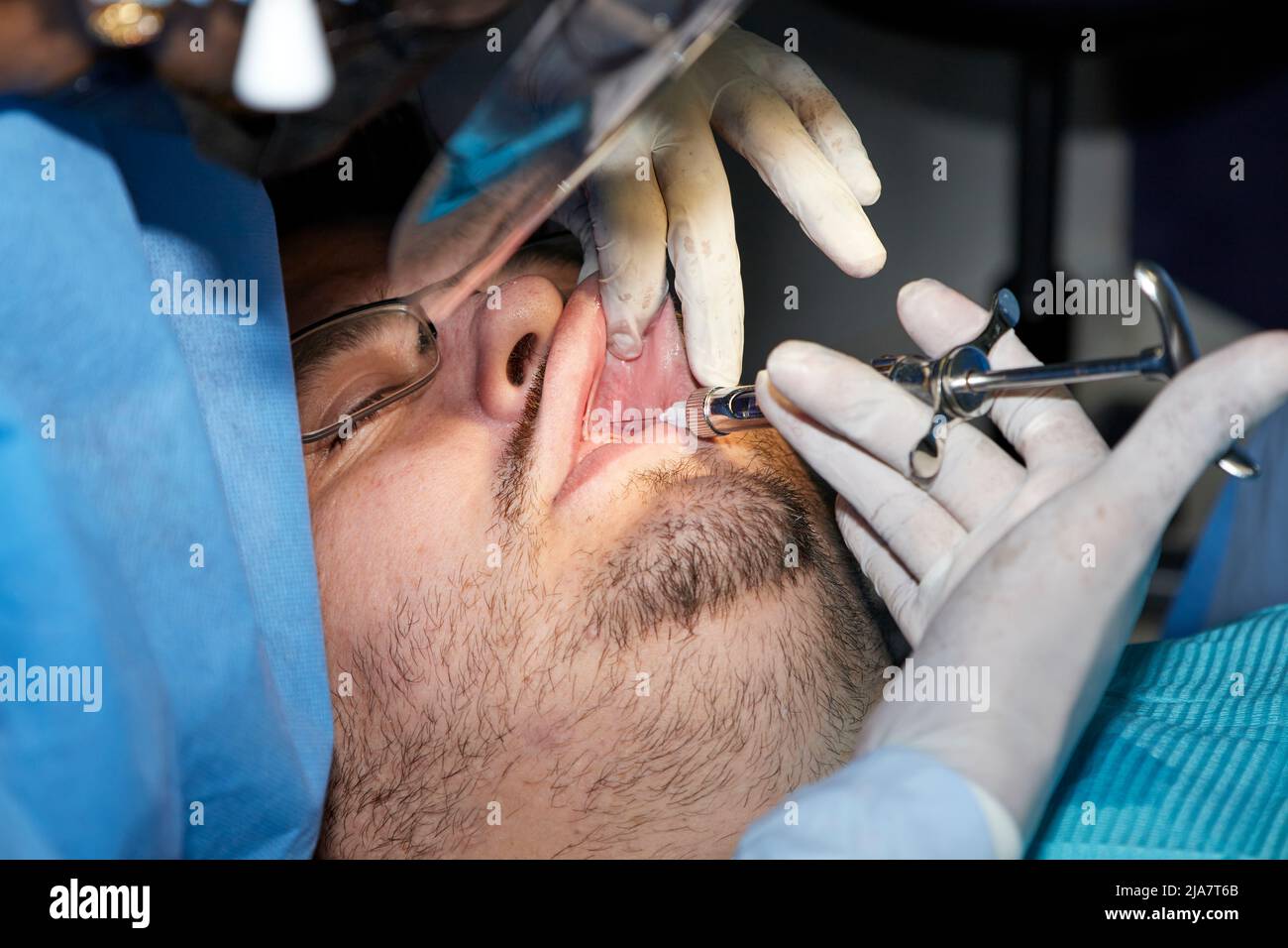 Un homme avec une barbe légère subissant une procédure dentaire Banque D'Images