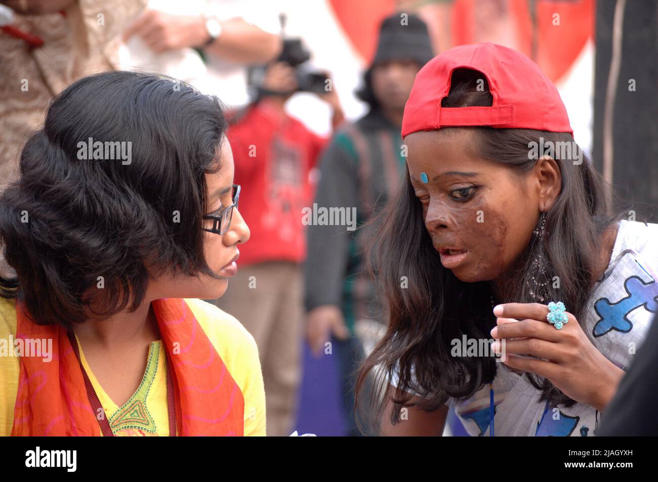 Une victime acide parle avec un journaliste. Dhaka, Bangladesh. La violence acide est une forme de violence au Bangladesh, où de l’acide est projeté dans le visage des gens. La majorité des victimes de violence acide sont des femmes. Les raisons signalées pour les attaques à jet d'acide incluent le refus d'une offre de mariage, les conflits de dot, les conflits intérieurs et les différends sur les biens. 7 mars 2008. Banque D'Images