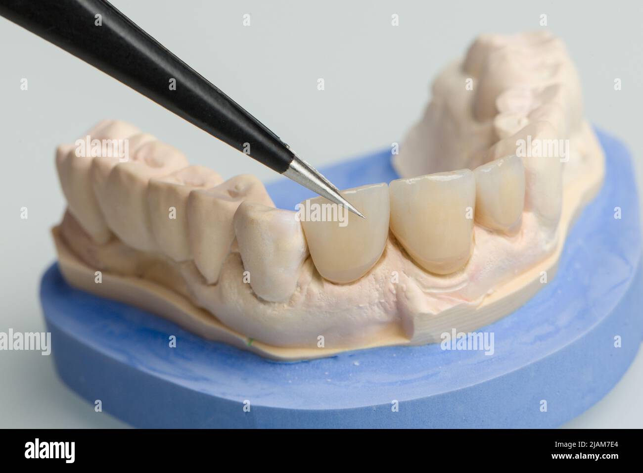 gros plan sur les pièces de prothèse dans un laboratoire dentaire Banque D'Images