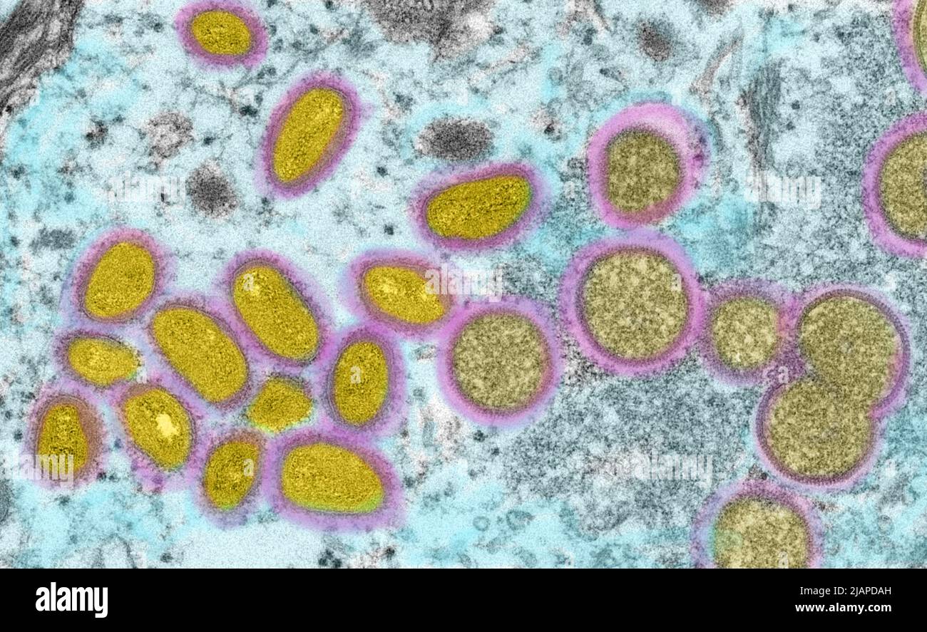 Cette image microscopique électronique (EM) a représenté un virion de la variole du singe, obtenu à partir d'un échantillon clinique associé à l'éclosion de chien de prairie de 2003. Il s'agissait d'une image de coupe mince d'un échantillon de peau humaine. À gauche se trouvaient des particules de virus matures de forme ovale, et à droite, des croissants et des particules sphériques de virions immatures. Une version optimisée et améliorée d'une image produite par les Centers for Disease Control and Prevention des États-Unis / Credit CDC /C.S. Goldsmith ; R.Regnery 2003. Rendu des couleurs erroné Banque D'Images